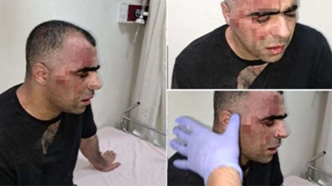 Gazeteci Sinan Aygül’e Saldırıda Yeni Gelişme: Tutuklandılar!