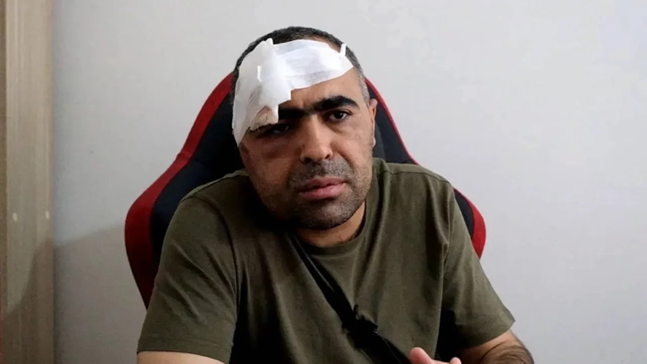 Saldırıya Uğrayan Sinan Aygül'den 'Barış' Açıklaması! Benim Davam Devam Ediyor