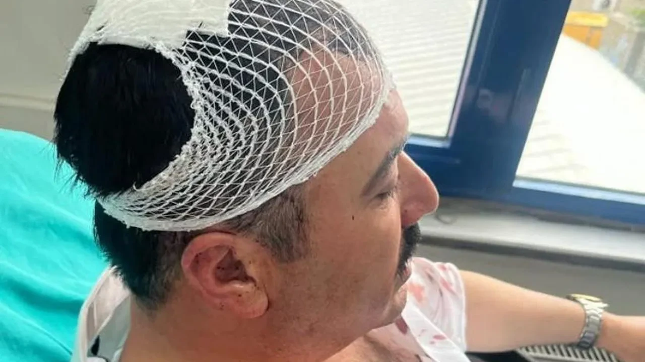 Yeniden refah partili başkan yardımcısı, belediye başkan yardımcısının kafasına şekerlikle vurdu