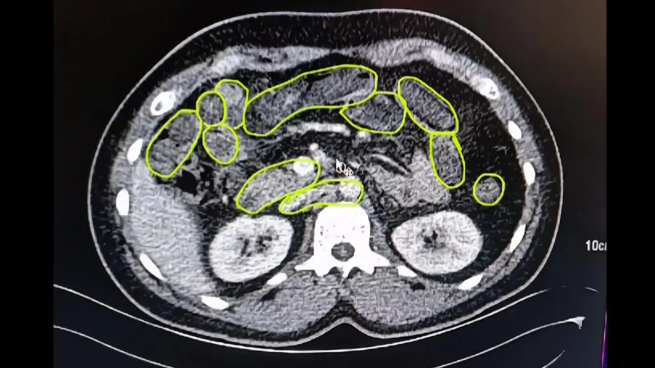 Kayseri polisi İrandan gelen uyuşturucu kuryelerini yakaladı