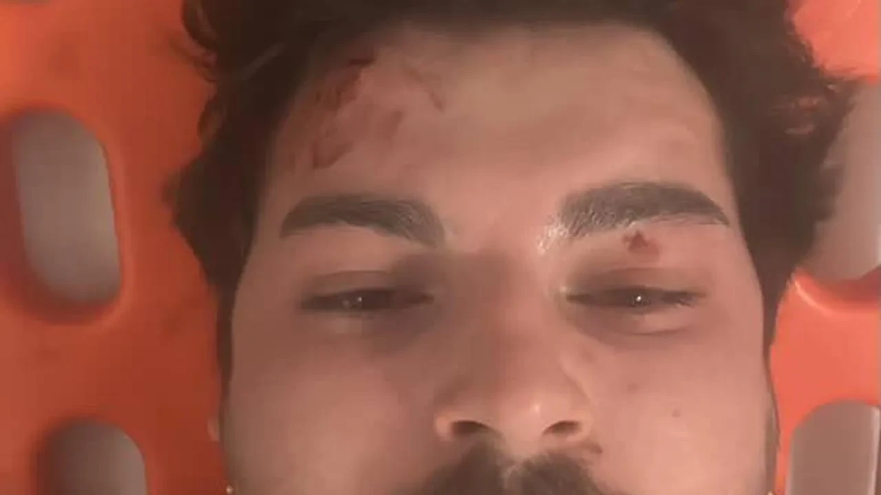 Oyuncu Mehmet Akif Akdeniz TEM Otoyolunda saldırıya uğradı