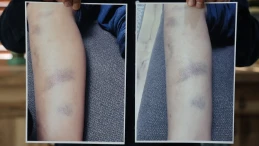 Diyarbakır’da özel okulda 8 yaşındaki çocuğun darbedildiği iddia edildi