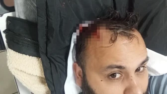 Kayseri'de Adem Ocaktan Boşanma Aşamasındaki Eşi Ve Ailesi Tarafından Darbedildi