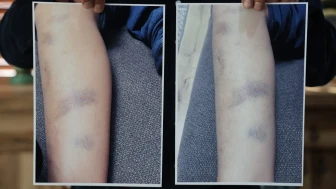 Diyarbakır’da özel okulda 8 yaşındaki çocuğun darbedildiği iddia edildi