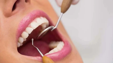 Diş Apsesi Neden Olur, Belirtileri ve Tedavi Yöntemleri