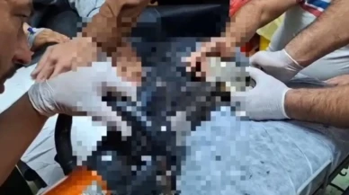 Tel Abyad'ta kıyma makinesine elini kaptıran çocuk Şanlıurfa’da tedavi edildi