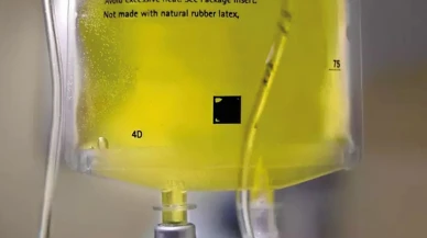 Evde uygulanan sarı serum bir can daha aldı: Adres bu kez İstanbul