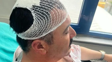 Yeniden refah partili başkan yardımcısı, belediye başkan yardımcısının kafasına şekerlikle vurdu