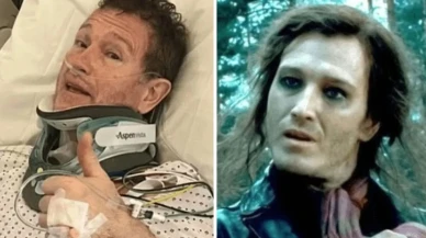 Harry Potter'ın Scabior'u Nick Moran, sağlık sorunlarıyla hastanelik oldu