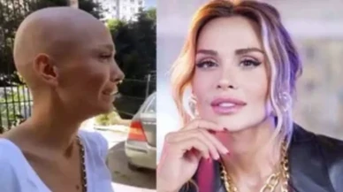 Şarkıcı Şimal, ışın tedavisi sonrası yüreklere dokunan o sözleri paylaştı: 'Çok yoruldum'