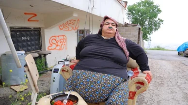 Bir çocuk annesinin zorlu yaşam mücadelesi: Kilosu 200'e dayandı