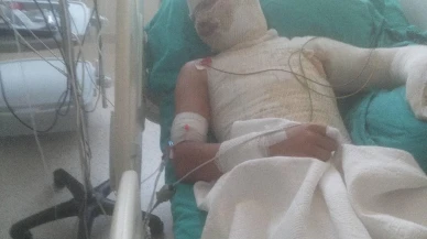 Adanada amca yeğenini yakıp suçu babaya attı