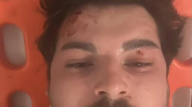 Oyuncu Mehmet Akif Akdeniz TEM Otoyolunda saldırıya uğradı