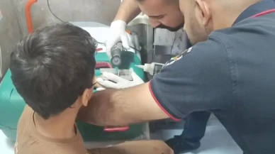 Şanlıurfa'da çocuğun parmağındaki cıvata pulu itfaiye ekipleri tarafından çıkarıldı