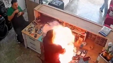 Aksaray’da telefon bataryası patlaması tamirci Ferhat Özkan’ı yaraladı